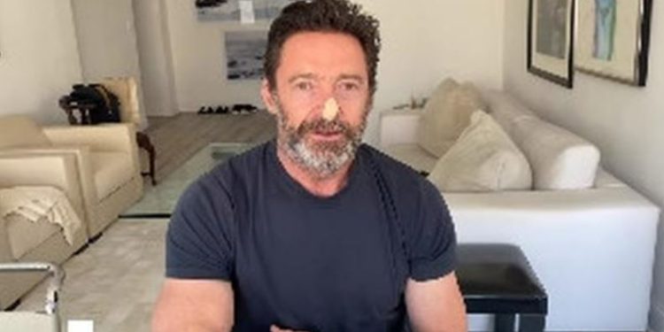 Cerita Hugh Jackman Hadapi Kanker Kulit, Beri Pesan Pentingnya Pakai Sunscreen